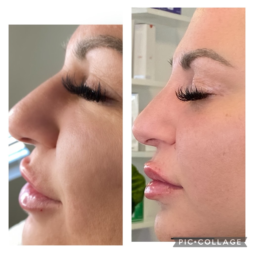 Clinique my face | 5551 Bd Laurier Suite 202, Terrebonne, QC J7M 1T7, Canada | Phone: (514) 980-6228