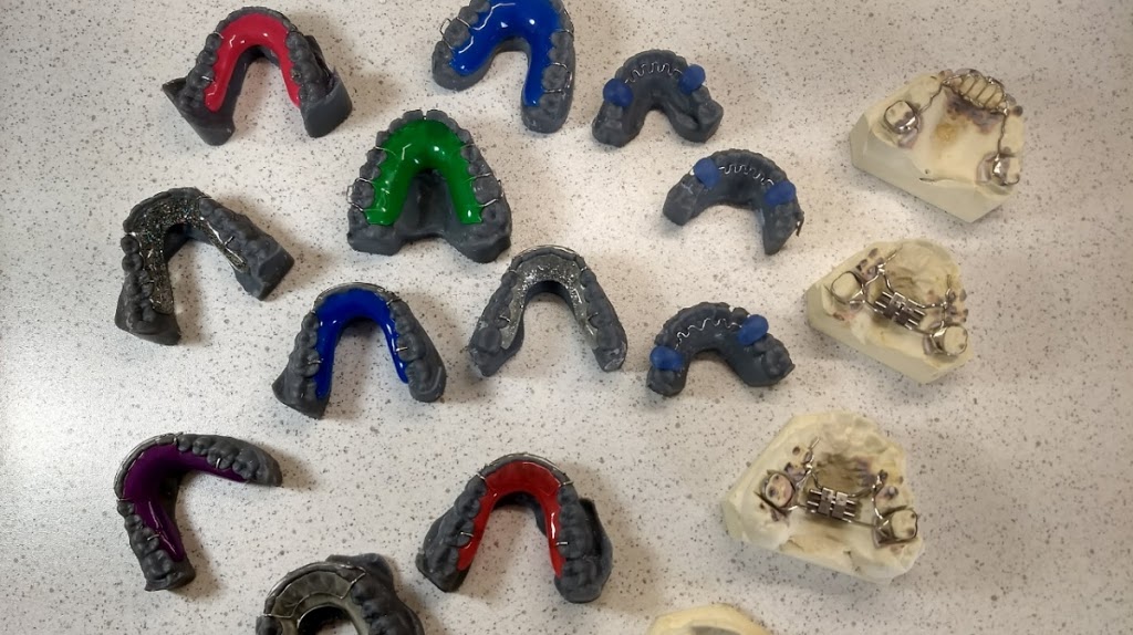 TriCity Orthodontic Lab | 1472 Blackwater Pl, Coquitlam, BC V3E 2R5, Canada | Phone: (778) 668-7170