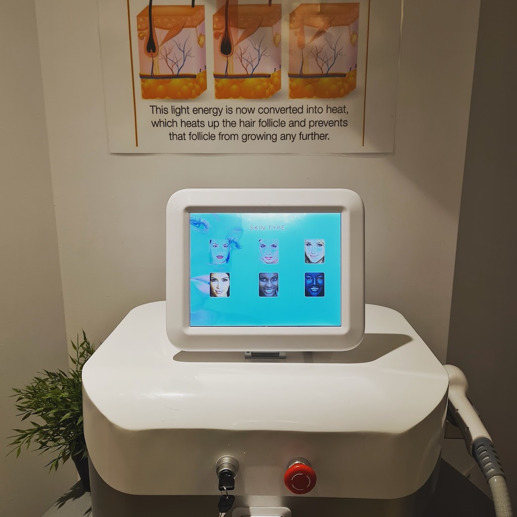 The Laser House | 171 Stonebridge Dr, Markham, ON L6C 2Z8, Canada | Phone: (647) 236-6928