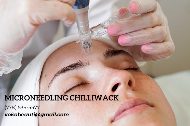 Voko Beauti Laser & Skin Care Clinic Chilliwack | 6396 Sumas Prairie Rd #3, Chilliwack, BC V2R 4N6, Canada | Phone: (778) 539-5577