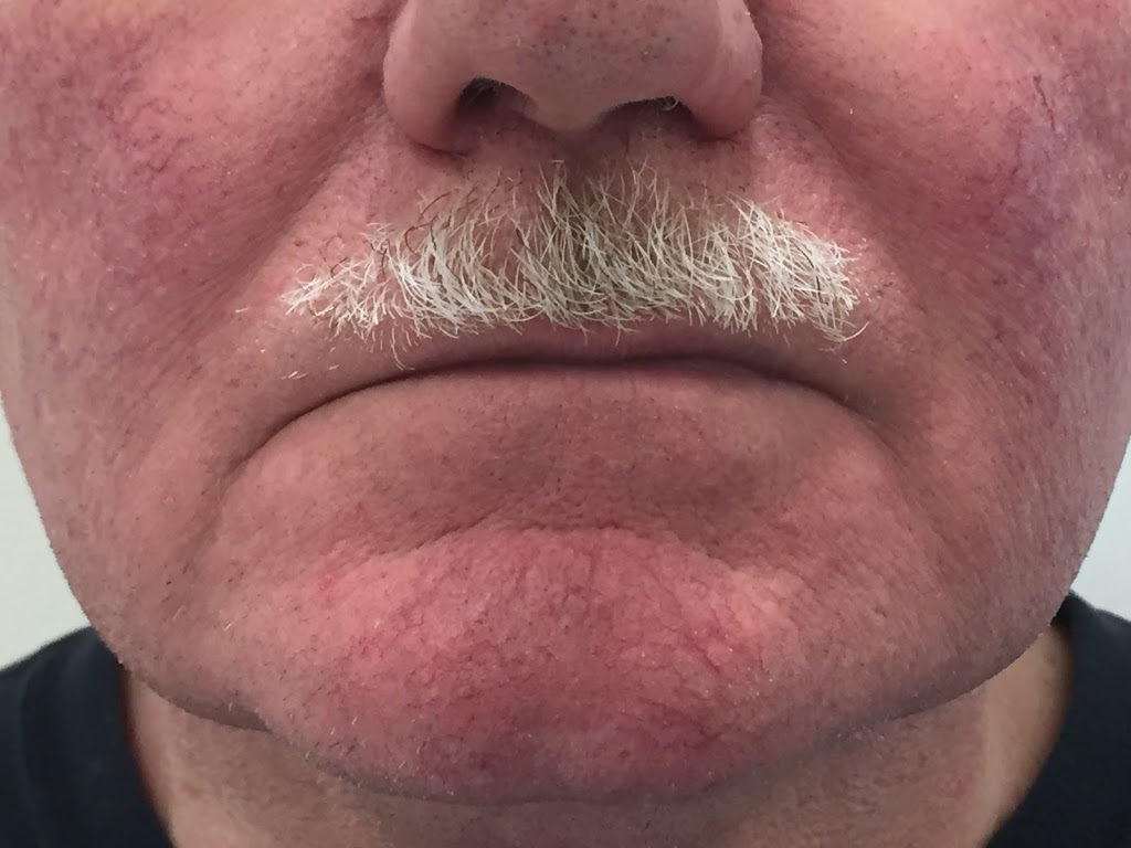 Self Aesthetics Laser and Skin Centre | 2-455 Sterling Lyon Pkwy, Winnipeg, MB R3P 2S8, Canada | Phone: (204) 237-1388