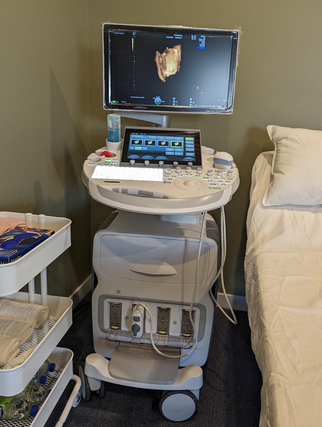 3D/4D BabyVision Ultrasound Kitchener | 591 Lancaster St W, Kitchener, ON N2K 1M5, Canada | Phone: (519) 571-7979