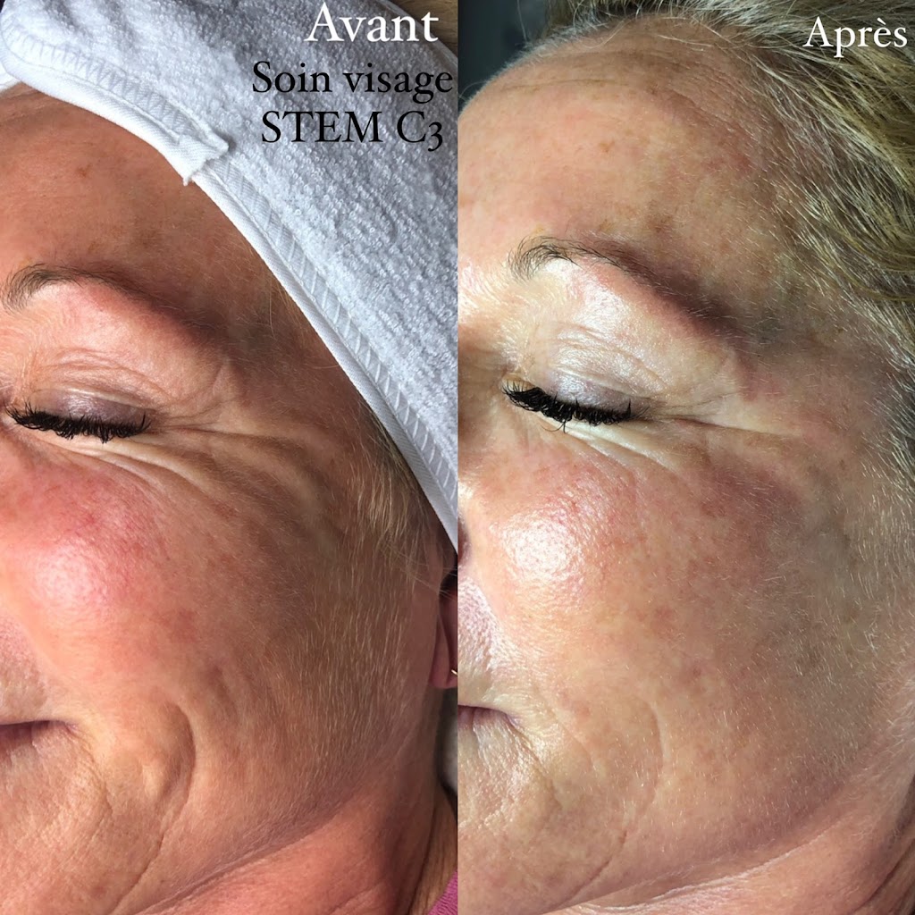 rr esthétique | 677-B Rue Notre-Dame, Repentigny, QC J6A 2W5, Canada | Phone: (514) 713-6836
