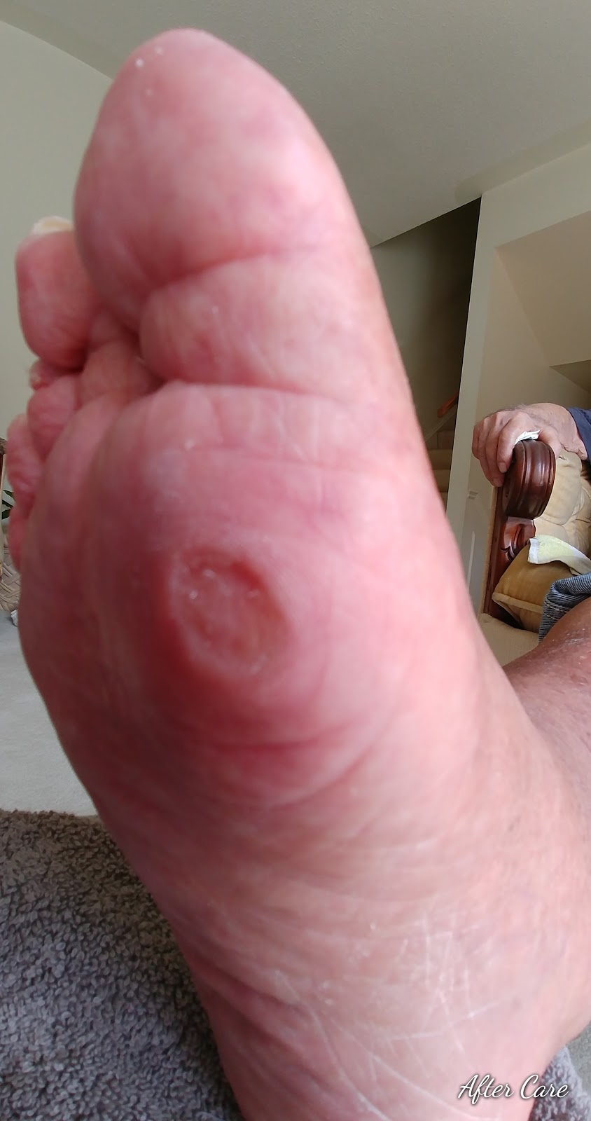 Healthy Feet Mobile Foot Care Services | Gough Ave, London, ON N5X 4P8, Canada | Phone: (519) 933-9155