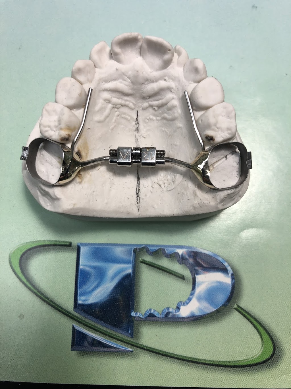 Preferred Ortho | 14065 Victoria Trail NW #207, Edmonton, AB T5Y 2B6, Canada | Phone: (780) 490-6585