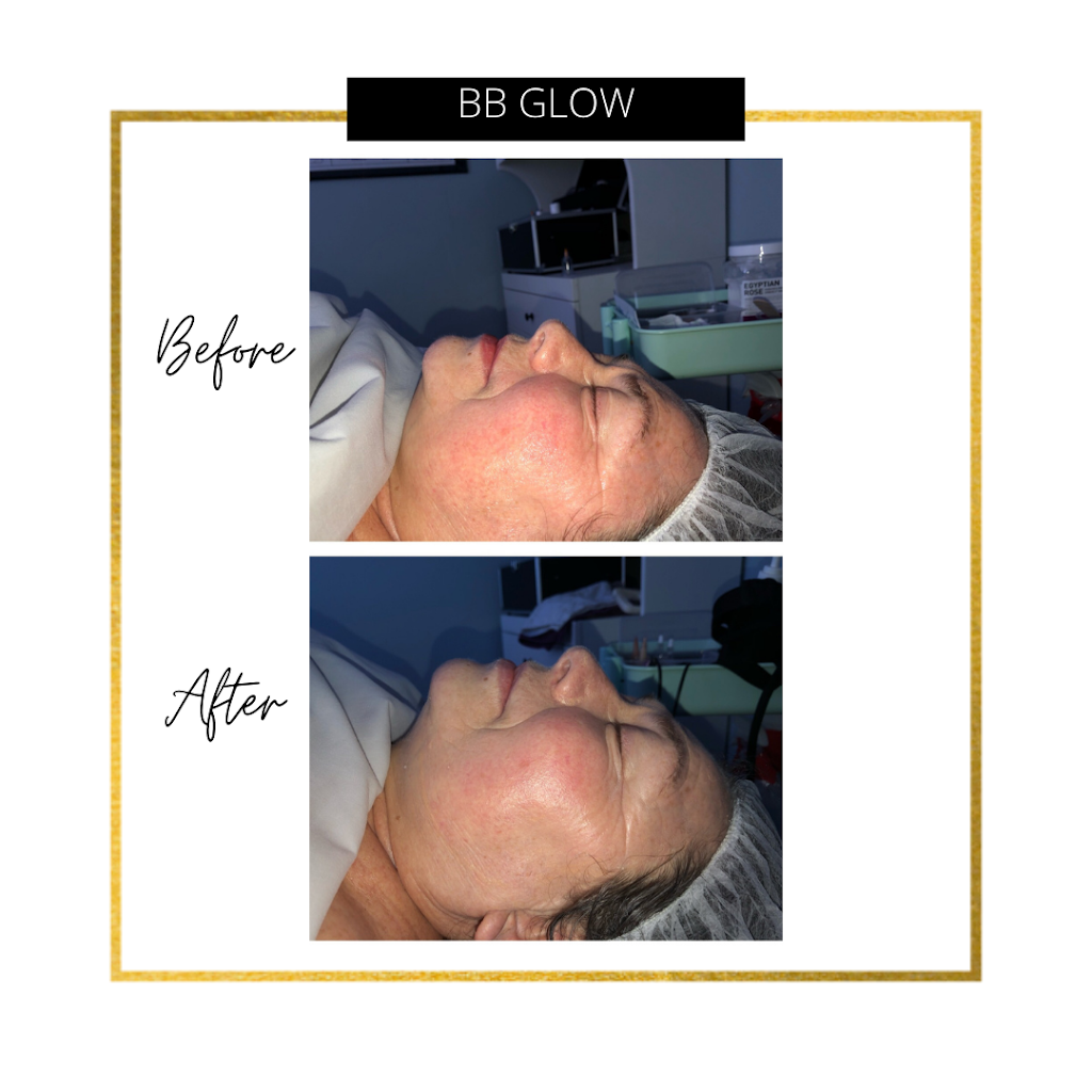 Vivid Aura | 2592 King St E, Hamilton, ON L8K 1Y2, Canada | Phone: (905) 560-2833