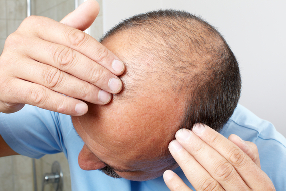 Dr Get Hair | 170 N Queen St K, Unit 18, Etobicoke, ON M9C 1A8, Canada | Phone: (844) 311-4684