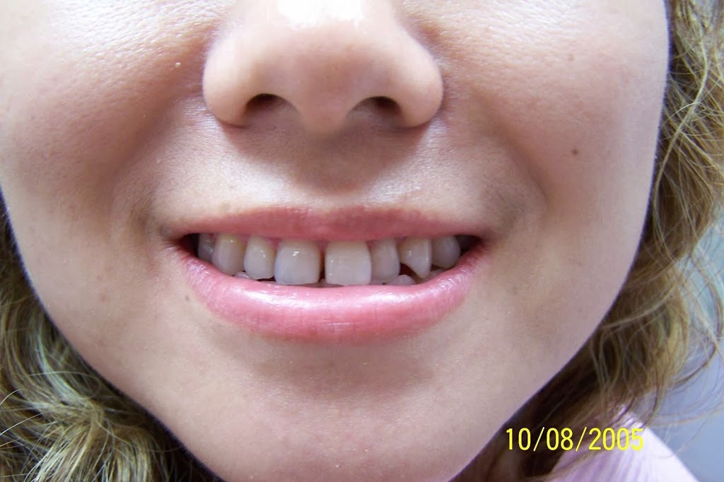 Dentistry on Lawrence | 709 Lawrence Ave W, North York, ON M6A 2B6, Canada | Phone: (416) 789-9969