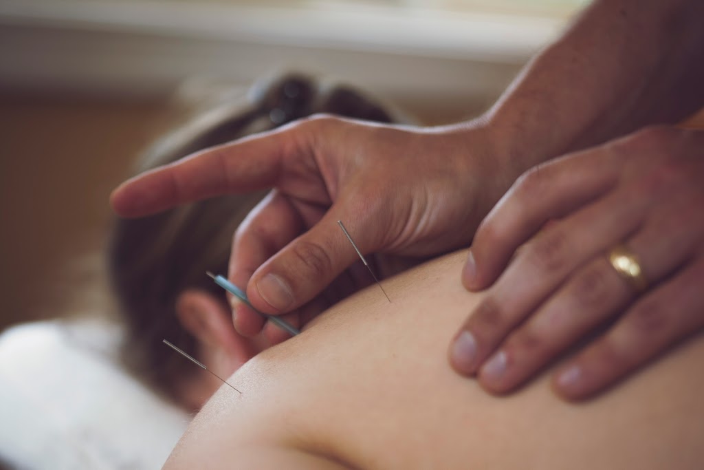 Oceanside Acupuncture & Massage Therapy | 1083 Middlegate Rd, Errington, BC V0R 1V0, Canada | Phone: (250) 228-4229