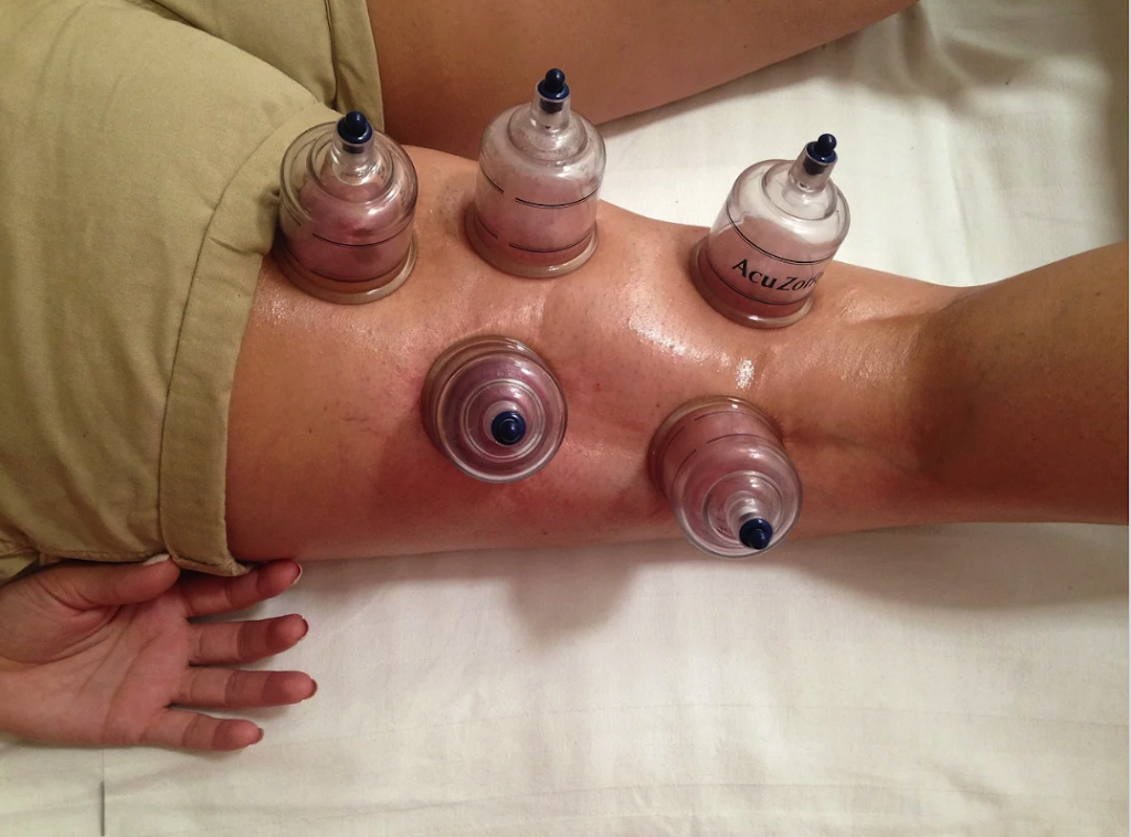 Acupuncture Isabelle Dufresne - Sherbrooke | 1871 Rue Galt O, Sherbrooke, QC J1K 1J5, Canada | Phone: (819) 943-9897