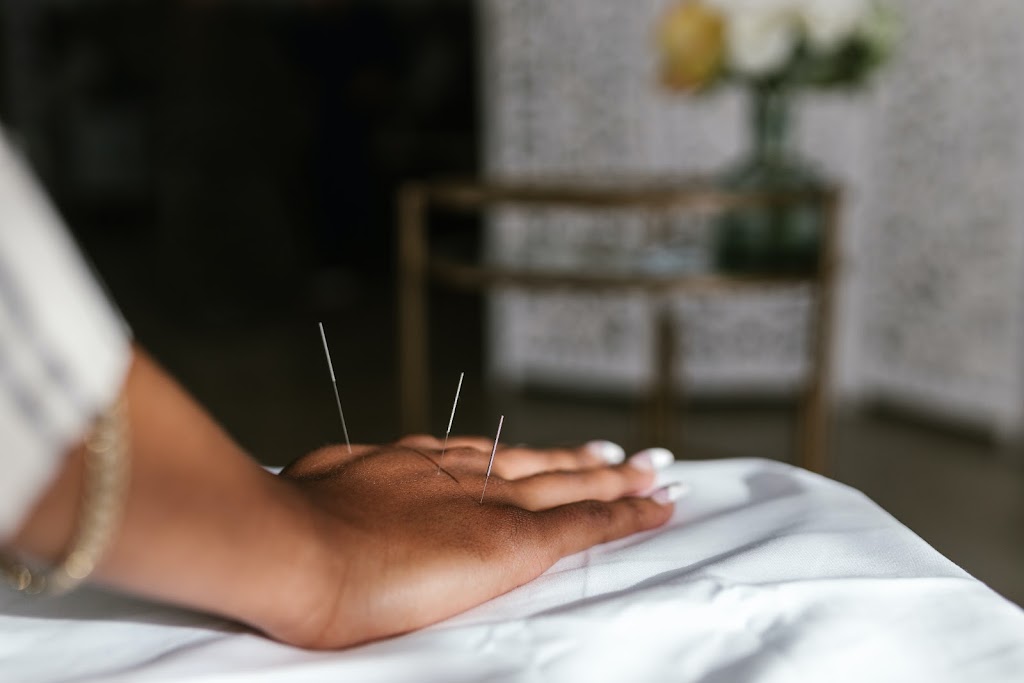 Acupuncture Alternative | 38 Queen St W, Cambridge, ON N3C 1G1, Canada | Phone: (519) 658-9492