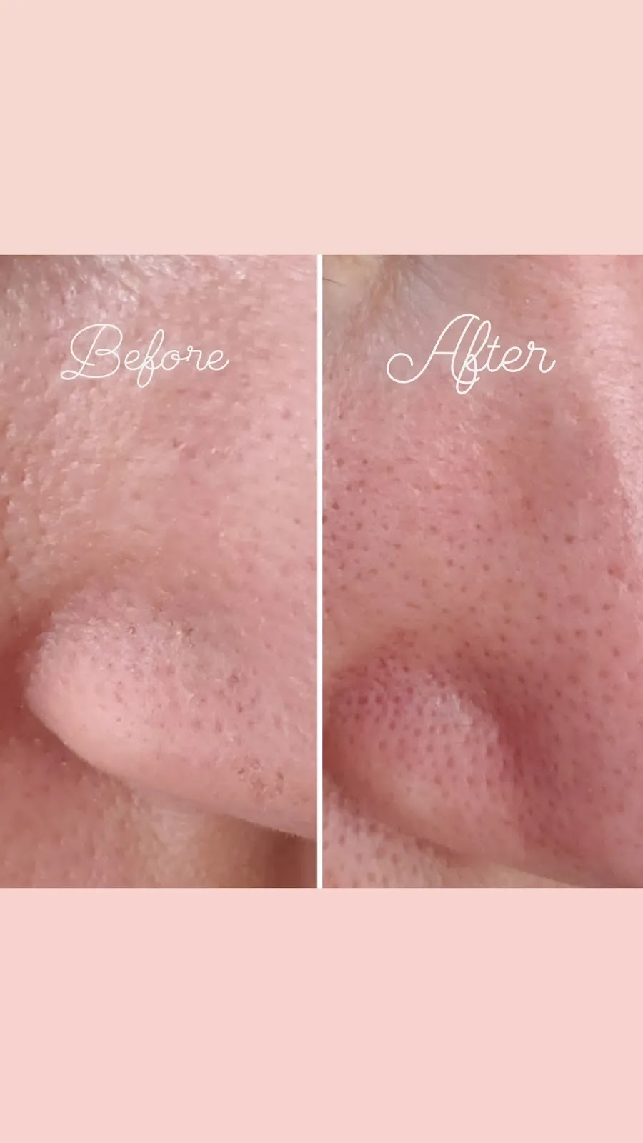 For rest and glowing skin | 203 Main St Unit 1A, Schomberg, ON L0G 1T0, Canada | Phone: (647) 909-0153