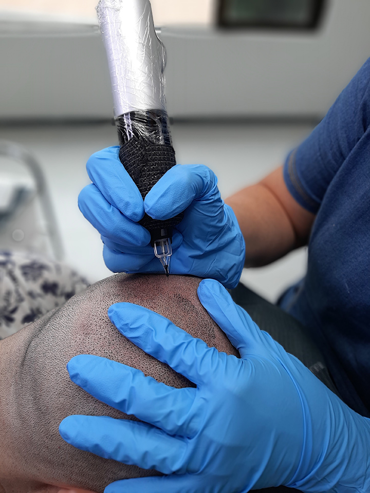 Micropigmentation Rive-Sud | 310 Boulevard Yvon-LHeureux N, Beloeil, QC J3G 5P2, Canada | Phone: (514) 714-6163