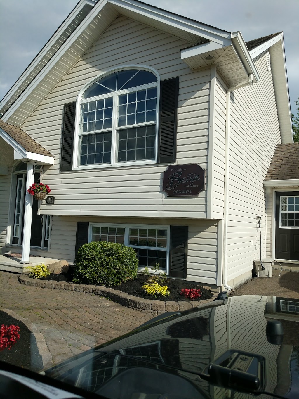 Belije Esthétique | 48 Mathilde Ct, Dieppe, NB E1A 7V2, Canada | Phone: (506) 962-2471