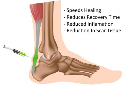 Coast Podiatry Brickyard Clinic - Dr. Adam Zanbilowicz | 4750 Suite 143 Rutherford Rd Backside of Nanaimo North Town Centre Near Life Labs, Nanaimo, BC V9T 4K6, Canada | Phone: (250) 754-7777