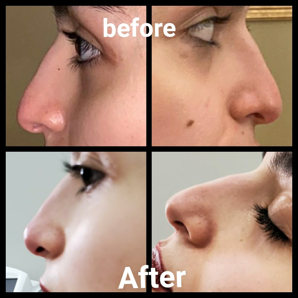 Rejuven Med Spa | 310 Chancellor Dr, Woodbridge, ON L4L 7M1, Canada | Phone: (647) 281-9951