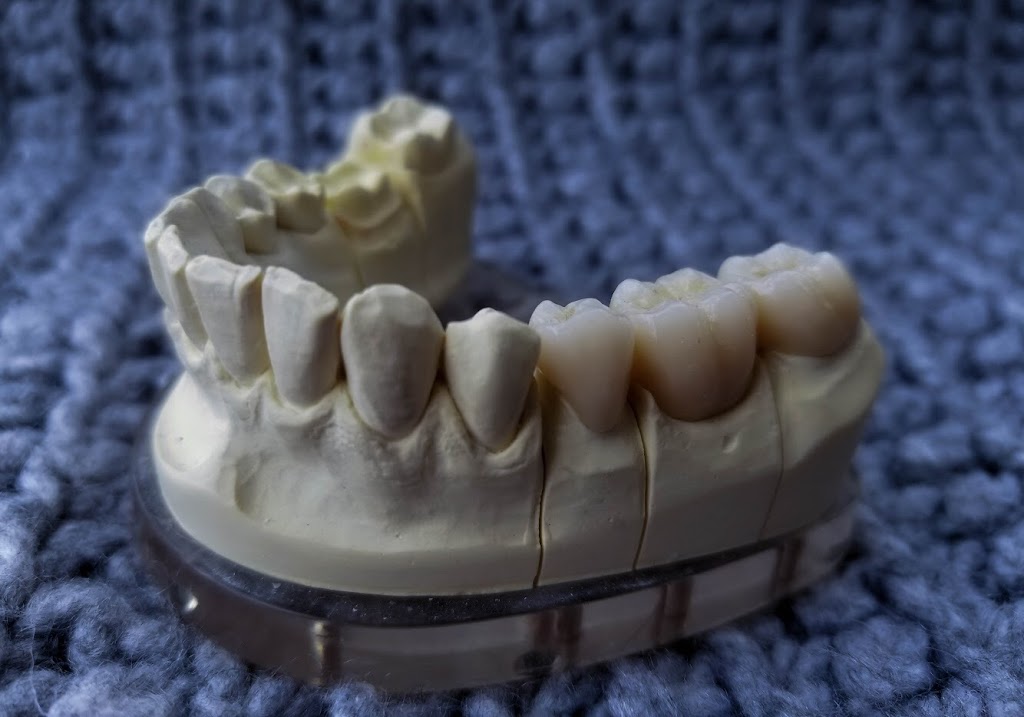 First Dental Studio | 10709 107 St NW Suite 201, Edmonton, AB T5H 2Y9, Canada | Phone: (780) 421-1890