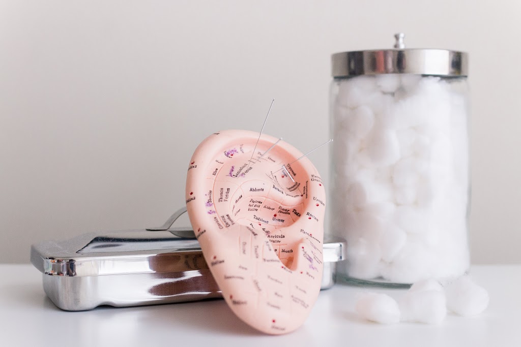 Acupuncture Charline Bet | 35 Rue Riverside, Saint-Lambert, QC J4R 1A1, Canada | Phone: (438) 888-5885