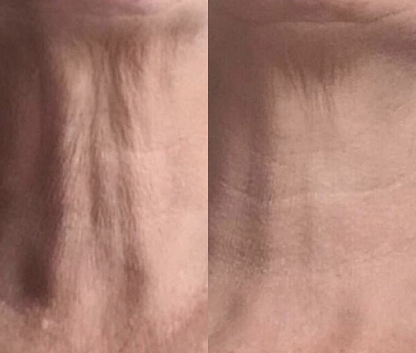 Anava Esthetics Studio Ltd | 9 Fairway Dr NW, Edmonton, AB T6J 2S6, Canada | Phone: (780) 432-3245