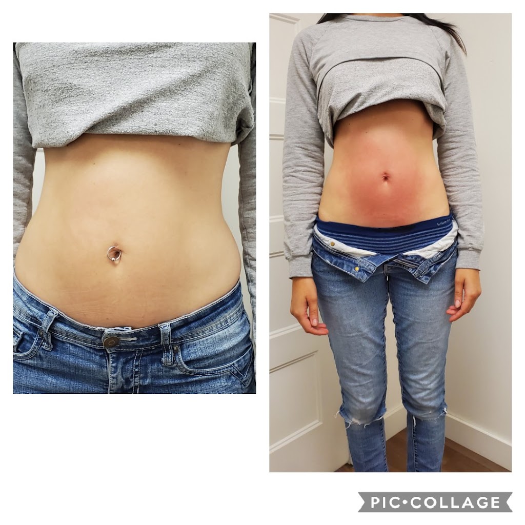 LUrbain Esthétique et Laser Drummondville | 2075 Bd Mercure, Drummondville, QC J2B 3P8, Canada | Phone: (819) 477-2468