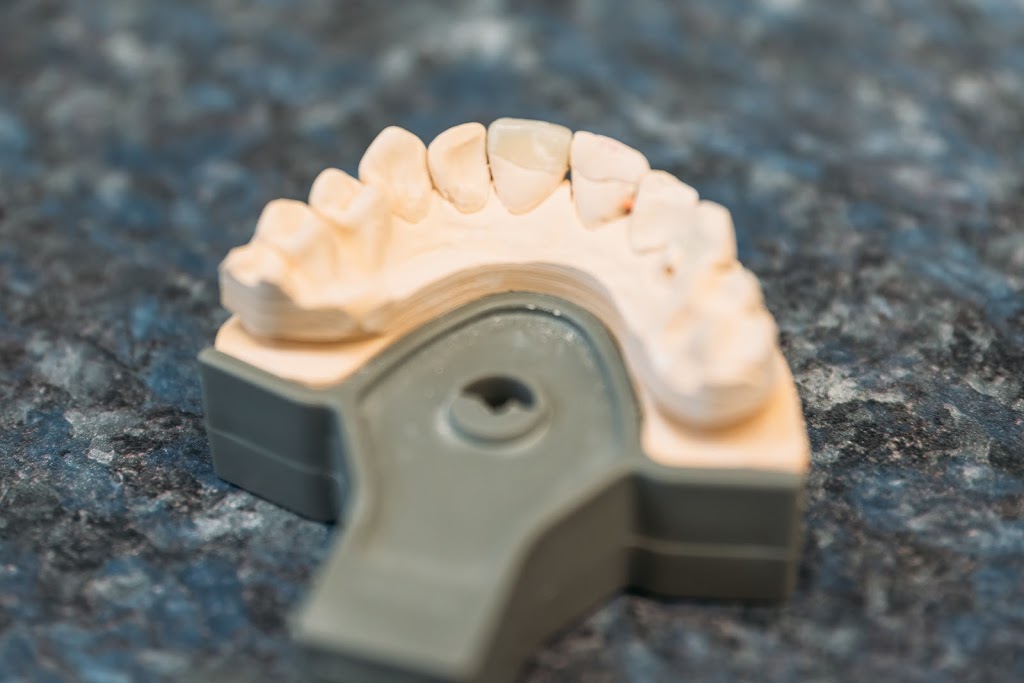 Schack Dental Ceramic Ltd | 757 K. L. O. Rd #1, Kelowna, BC V1Y 9L8, Canada | Phone: (250) 860-1727