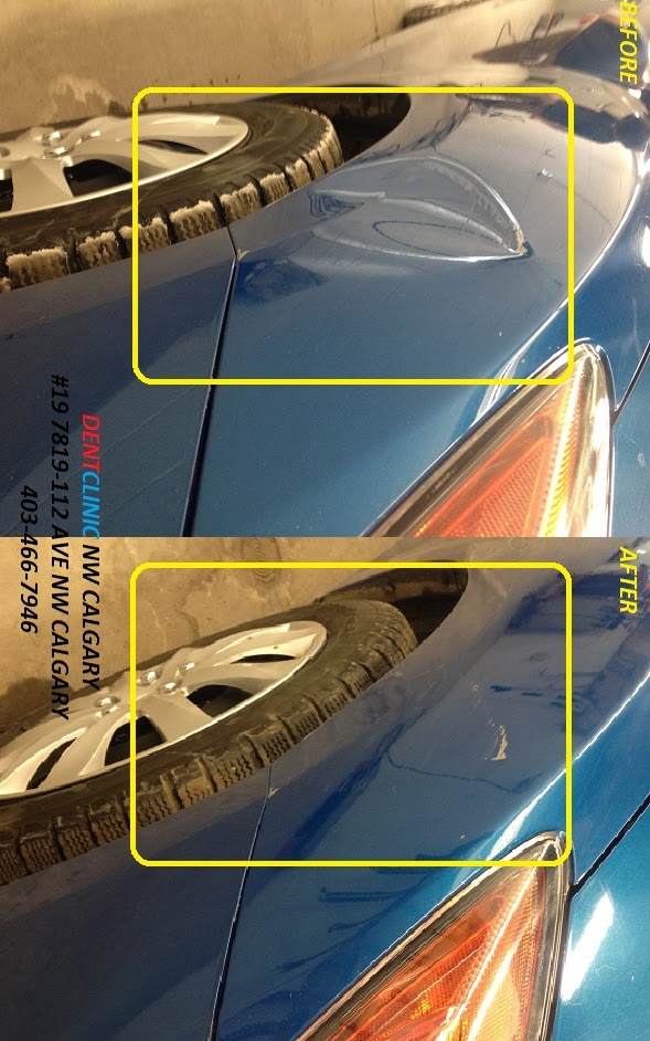 Dent Clinic | 7819 112 Ave NW, Calgary, AB T3R 1R8, Canada | Phone: (403) 466-7946