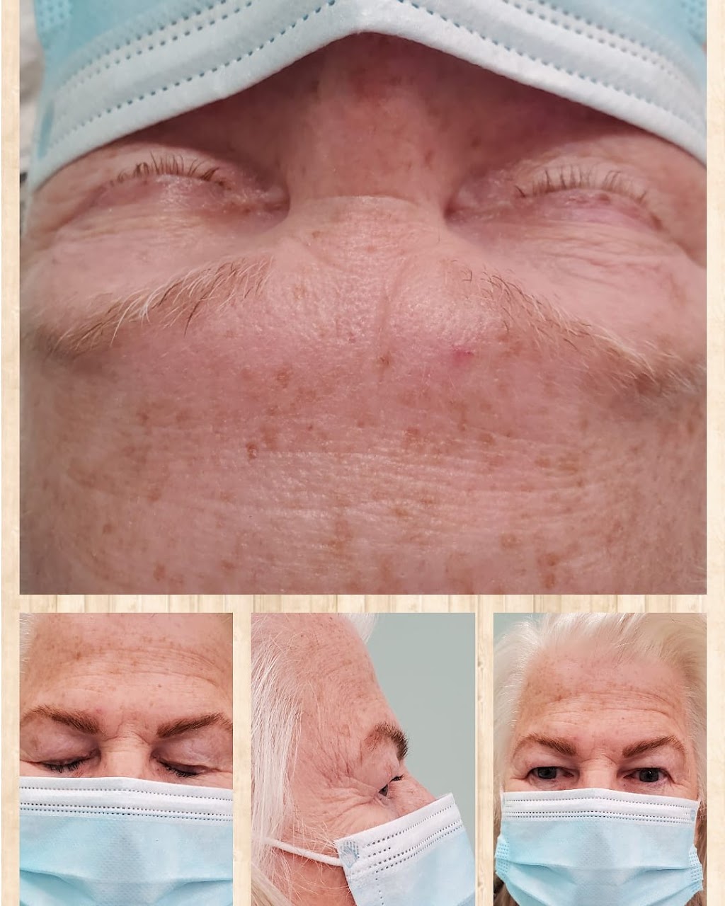 Valencia Body Contouring Inc. | 147 Bridlecrest St SW, Calgary, AB T2Y 5J1, Canada | Phone: (403) 473-4622