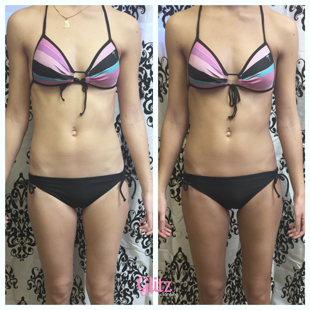 Glitz Spray Tanning | 1606 Sherwood Dr, Sherwood Park, AB T8A 1G5, Canada | Phone: (780) 691-8842