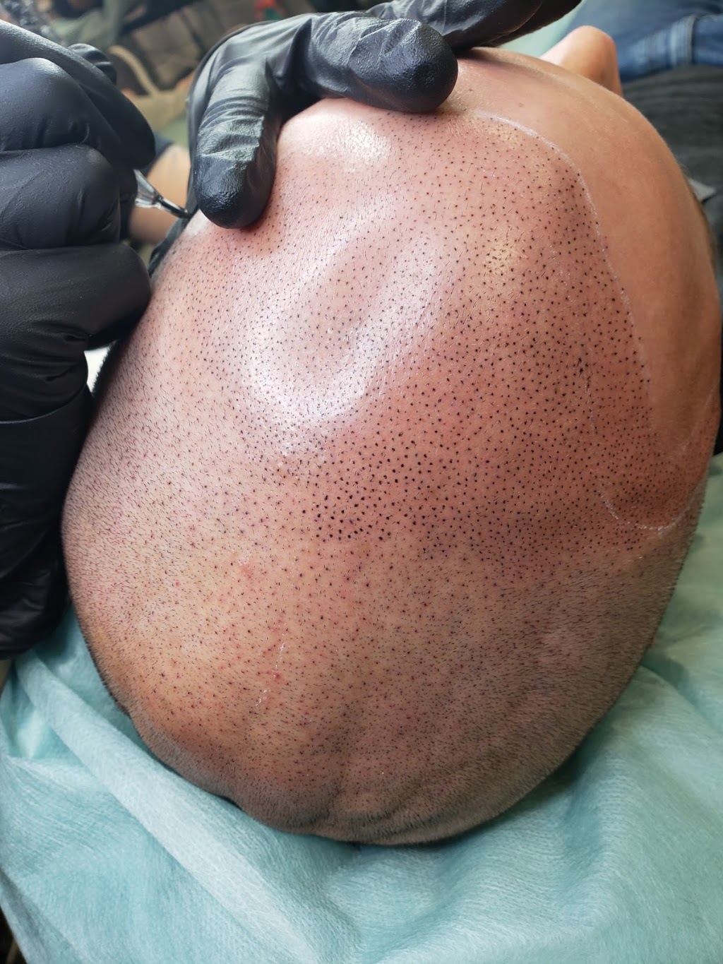 Kim Roy | Micropigmentation Capillaire, Salon de Coiffure & Barb | 215 QC-255, Wotton, QC J0A 1N0, Canada | Phone: (819) 828-3497