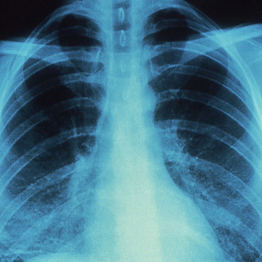 ADC X-Ray & Ultrasound | 3301 17 Ave SE #20, Calgary, AB T2A 0R2, Canada | Phone: (587) 351-9729