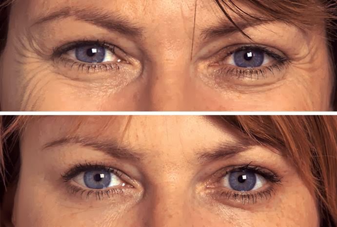 Dr Suzanne Leaf Cosmetic Clinic | 189 Elm St, St Thomas, ON N5R 5C4, Canada | Phone: (519) 207-5323