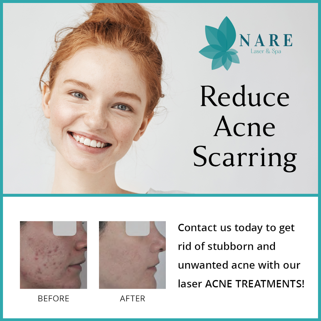 NARE Laser & Spa | 1366 Lawrence Ave W, North York, ON M6L 1A7, Canada | Phone: (416) 697-6375