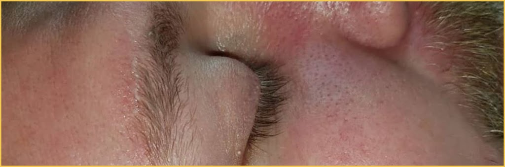 Awaken HydraFacial Windsor | 3926 Concession Rd 6, Windsor, ON N9G 2H4, Canada | Phone: (226) 777-6645