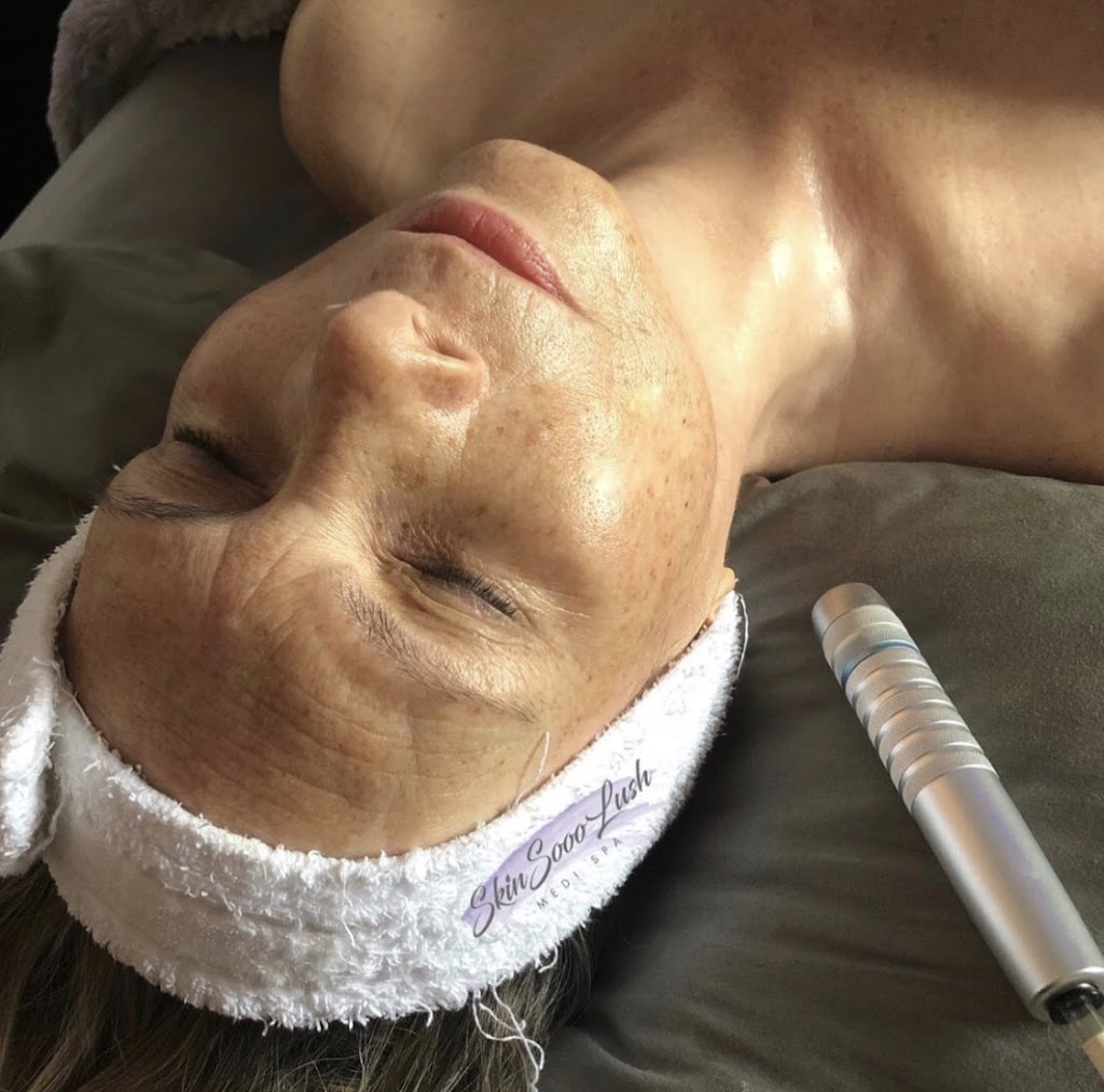 Skinsooolush Medi Spa | 278 Queen St S 2nd Floor, Bolton, ON L7E 4Z5, Canada | Phone: (647) 527-7546