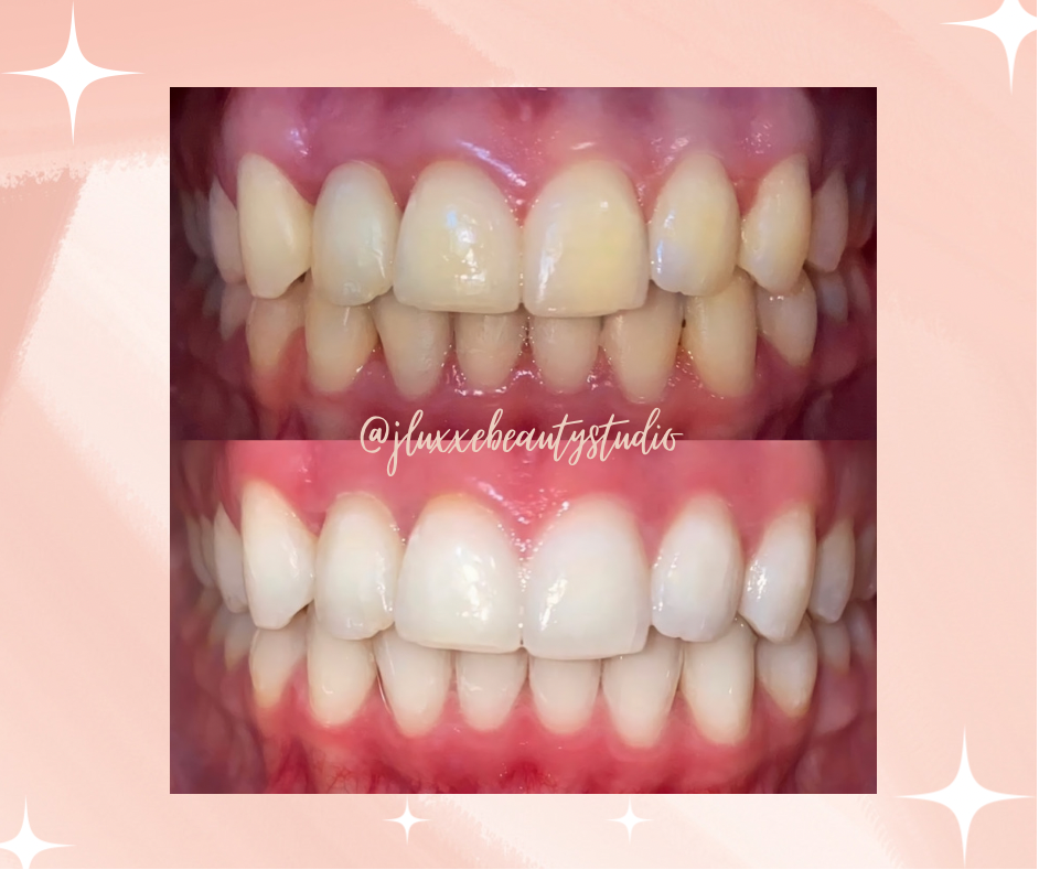 JLuxxe Beauty Studio | McKay Ave, Burnaby, BC V5J 3R9, Canada | Phone: (236) 512-6348