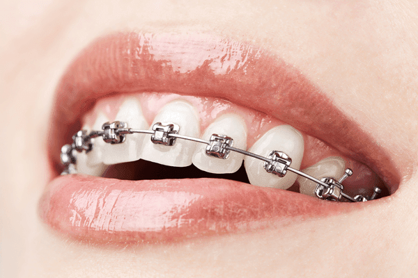 Brantford North Dental | 525 Park Rd N Suite 102, Brantford, ON N3R 7K8, Canada | Phone: (519) 759-0049