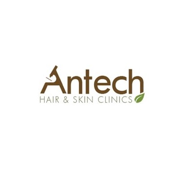 Antech Hair Clinic | 2325 Hurontario St #18a, Mississauga, ON L5A 4K4, Canada | Phone: (905) 896-1074