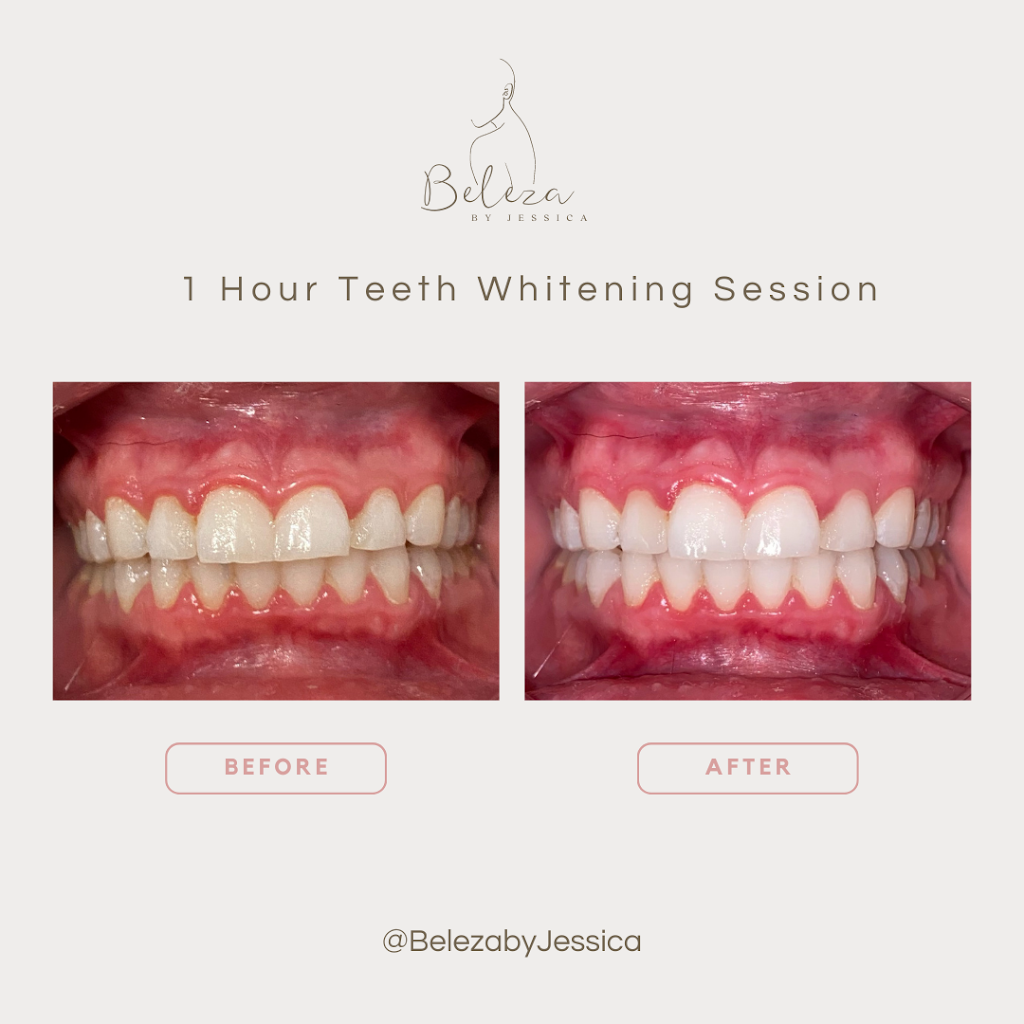 Beleza By Jessica | 406 Cundles Rd W, Barrie, ON L4N 7C6, Canada | Phone: (416) 558-1423