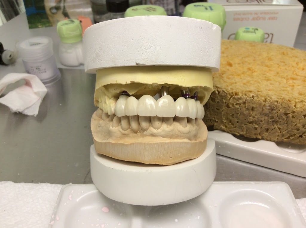 Proceram Dental Arts | 203-34654 Delair Rd, Abbotsford, BC V2S 2C9, Canada | Phone: (604) 853-7793