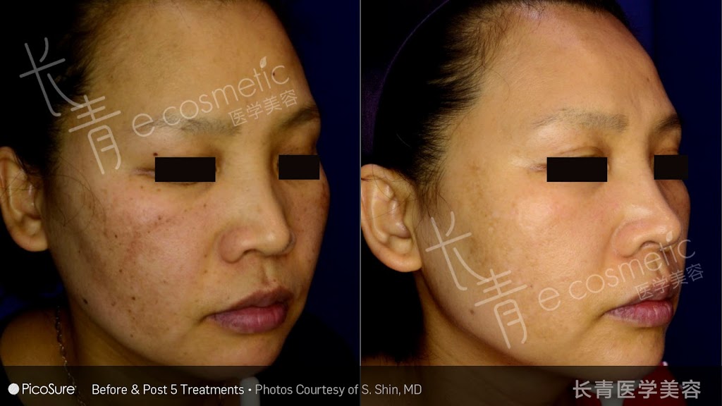 长青医学美容 - Evergreen Cosmetic | 500 Royal Oak Dr NW #216, Calgary, AB T3G 5J7, Canada | Phone: (403) 680-9960
