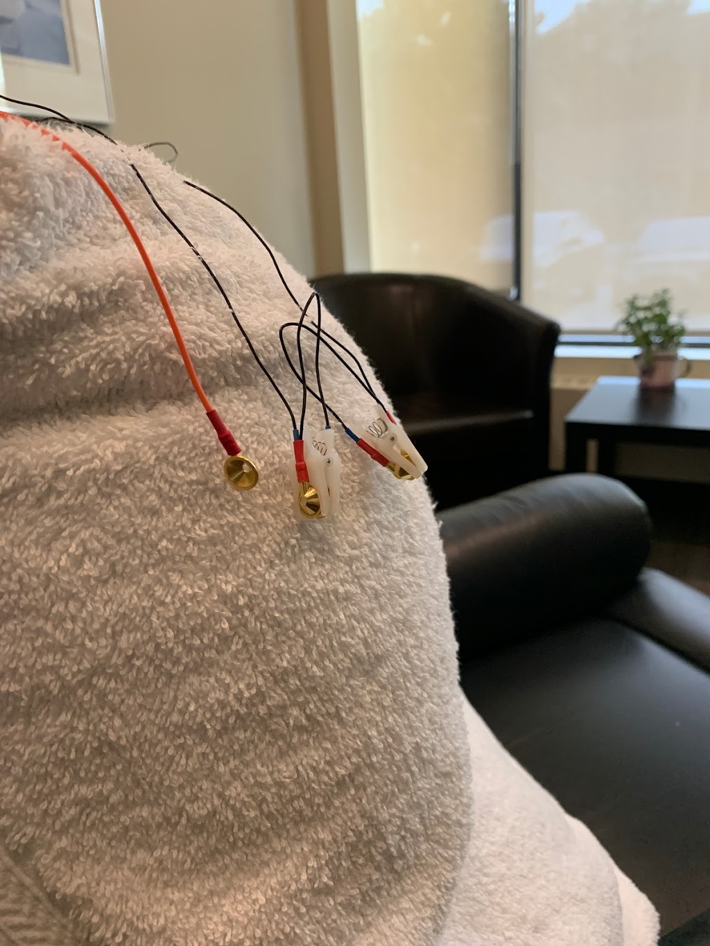 Myosymmetries | 101-1011 Glenmore Trail SW, Calgary, AB T2V 4R6, Canada | Phone: (403) 225-0900