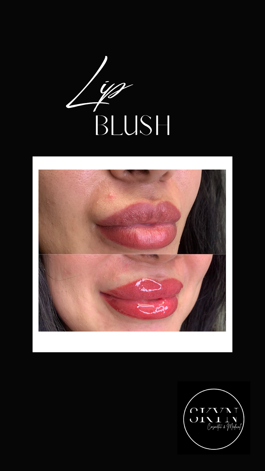 SKYN Cosmetic & Medical Studio | 5920 Turney Dr, Mississauga, ON L5M 2R8, Canada | Phone: (905) 812-0513
