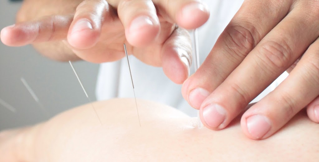 Acupuncture entre Ciel Et Terre | 695 Avenue de la Station #201, Shawinigan, QC G9N 1V9, Canada | Phone: (819) 244-4729