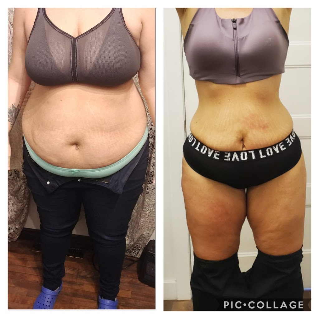 LUrbain Esthétique et Laser Drummondville | 2075 Bd Mercure, Drummondville, QC J2B 3P8, Canada | Phone: (819) 477-2468