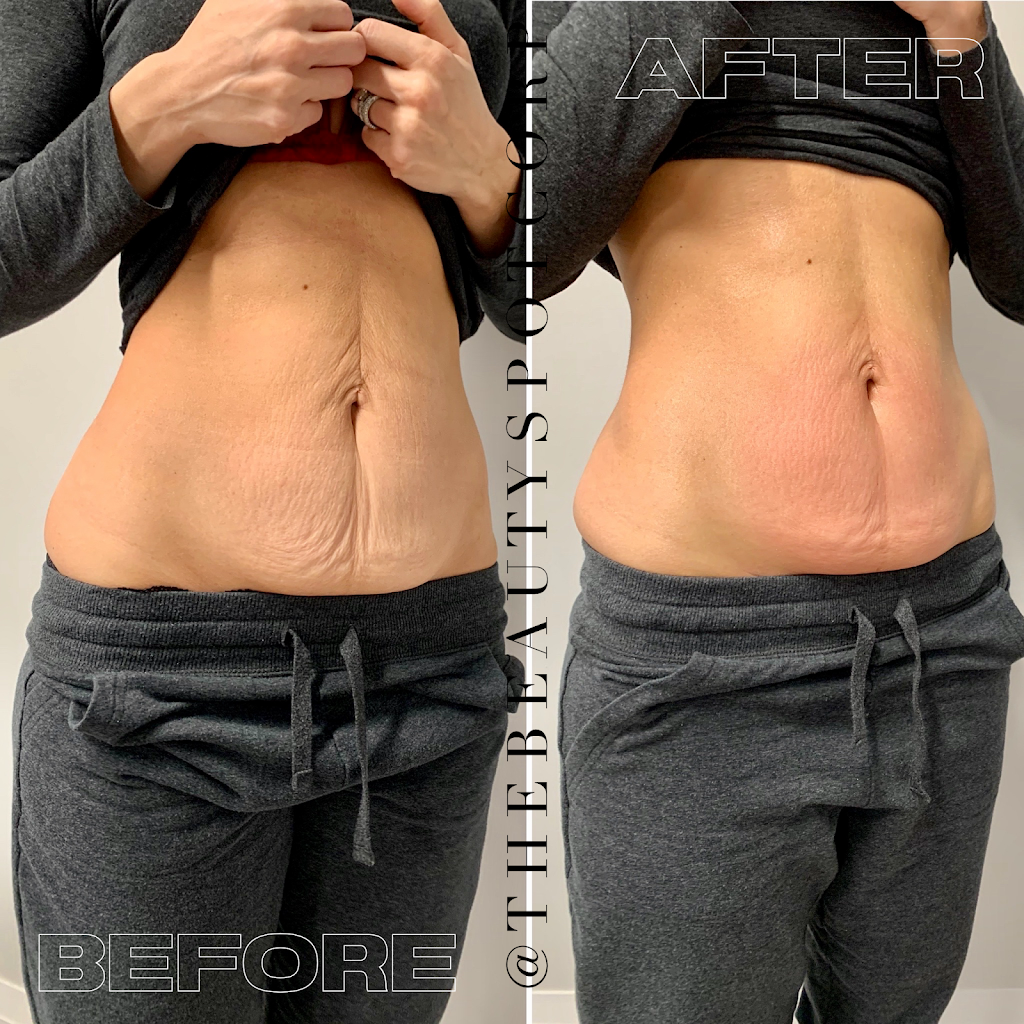 The Beauty Spot Corp. | 397 Kleinburg Smt Wy #1, Kleinburg, ON L4H 4T1, Canada | Phone: (647) 778-7356