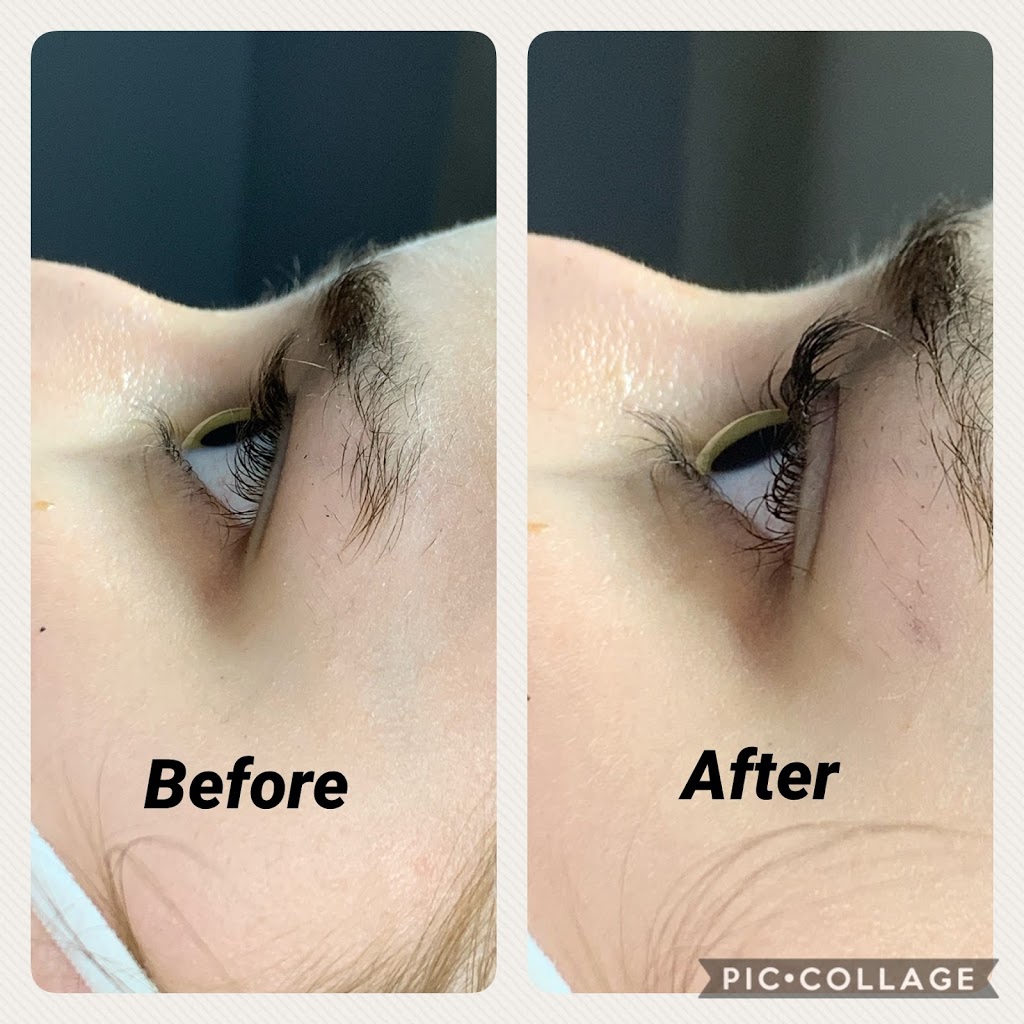 LaserHaven & Beauty | 2480 Strandherd Dr, Nepean, ON K2G 4S4, Canada | Phone: (613) 265-6932