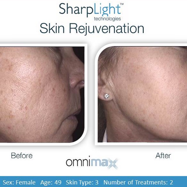 Avantika Clinic | 333 Wyecroft Rd Unit 1, Oakville, ON L6K 2H2, Canada | Phone: (289) 837-0037