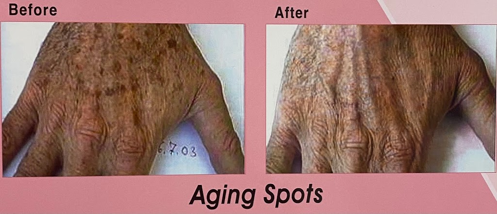 Laura Beauty & Laser Home Med Spa | 144 Solomon Crescent, Hamilton, ON L8W 2G7, Canada | Phone: (289) 775-8875