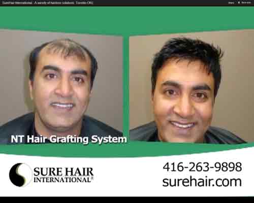 Sure Hair International | 55 Wyndham St N Suite T7, Guelph, ON N1H 7T8, Canada | Phone: (416) 747-7873