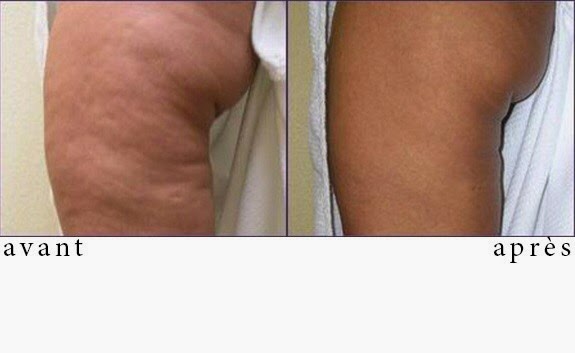 Clinique Médico-Esthétique In Situ | 131 Chemin Ozias-Leduc, Mont-Saint-Hilaire, QC J3H 3W6, Canada | Phone: (450) 714-1008